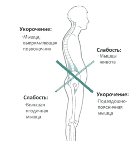 Лечение гипотонуса в Кременчуге