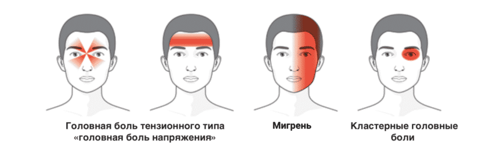Лечение головных болей в Кременчуге